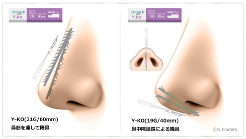 鼻の形のイメージ